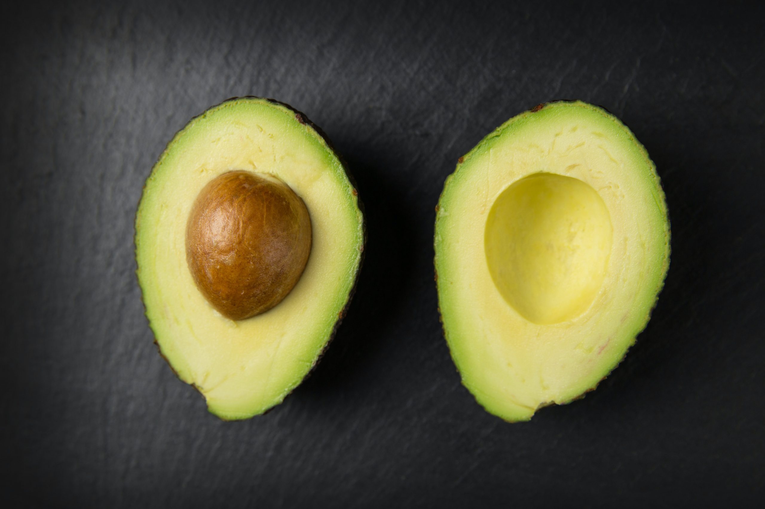 ¿Aguacate o palta? Los distintos nombres que tiene en el mundo